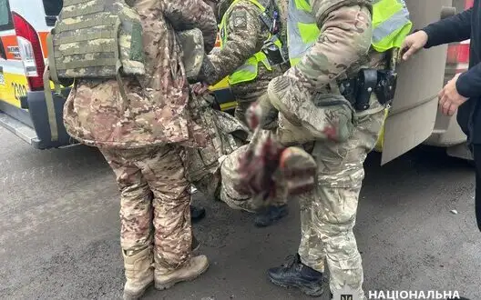 Three police officers and two civilians wounded in Russian attack on Kupyansk. PHOTOS