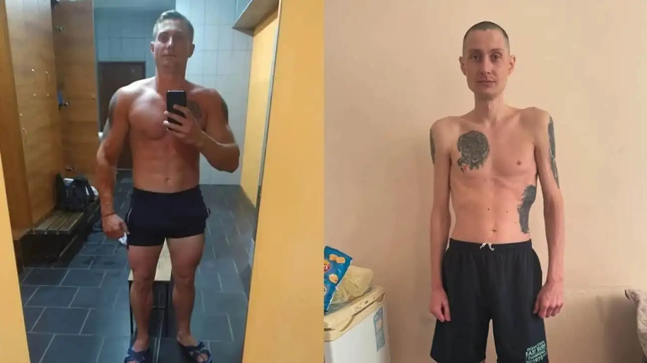 Ukrainian National Guard officer shows shocking 40kg weight loss in before-and-after photos after release from Russian captivity