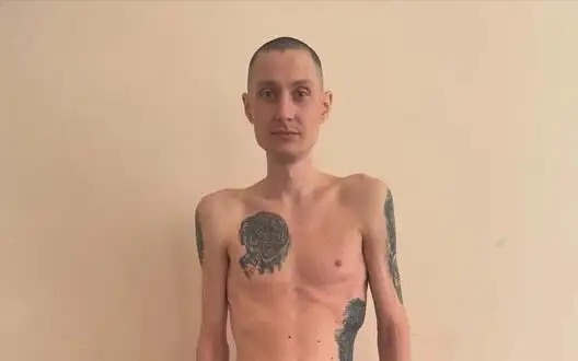 1037 days and minus 40 kilograms: National Guard soldier Petrovskyi before and after Russian captivity. PHOTO