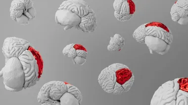 Вакцина от лишая может победить деменцию: ученые обнаружили ее необычное влияние на наш мозг