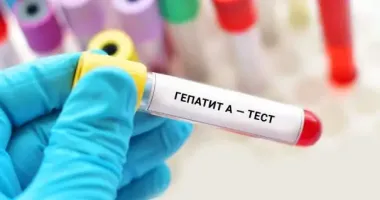 В Киеве зафиксировали вспышку гепатита A: что известно