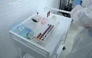 У Києві виявили десятки хворих на гепатит А