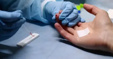 Спалах гепатиту А в столиці: на Відрадному стартує безкоштовне обстеження