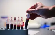 Сколько случаев ВИЧ-инфекции зафиксировали с начала года: МОЗ назвал цифру