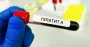 У Києві зросла кількість випадків гепатиту А: 30 людей госпіталізовані