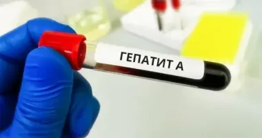 У Києві зросла кількість випадків гепатиту А: 30 людей госпіталізовані