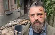 У Києві на американця впав балкон - КМВА
