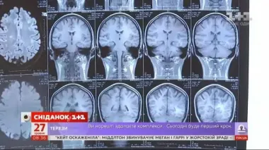 Вчені виявили бактерії, які можуть провокувати розсіяний склероз