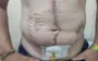 Russians burned words "Glory to Russia" into body of captured Ukrainian soldier. PHOTO OF THE DAY