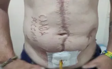 Russians burned words "Glory to Russia" into body of captured Ukrainian soldier. PHOTO OF THE DAY