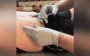 Doctor on inscription "Glory to Russia" burned on body of captured soldier: It was done by surgeon