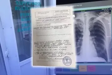 На Вінниччині заброньованого чоловіка двічі побили у ТЦК: триває розслідування, - ЗМІ
