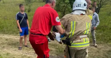 В Винницкой области 14-летний подросток играл с друзьями и проткнул ногу гвоздями
