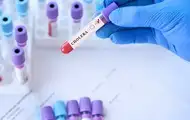 В Польше зафиксирован первый случай холеры  за шесть лет