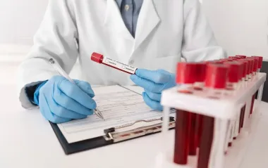 ВІЛ не передається через поцілунок і укуси комарів: МОЗ розвінчав найпоширеніші міфи
