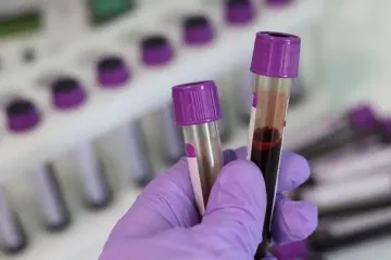 Вирус, унесший 100 миллионов жизней, воссоздали в лаборатории