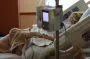 Смертельно опасный "забытый родственник" ВИЧ вызывает паралич и агрессивный рак: что о нем известно