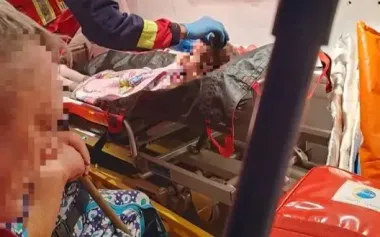 6-year-old girl wounded in Kupiansk is in serious condition; it is being investigated why she was not evacuated. PHOTO