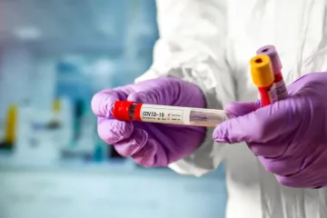 Пик COVID-19 в Украине: за месяц число заболевших увеличилось в 12 раз (инфографика)