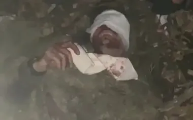 Occupiers were left without dugout, shoes, or toes after their "encounter" with Ukrainian drone. VIDEO