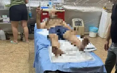 Occupiers wound civilian in Kupiansk: man evacuated to Kharkiv – Prosecutor’s Office. PHOTO