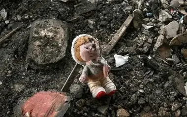 4-year-old girl injured in village near Krasnopillia in serious condition with burns. She will be transported to Okhmatdyt