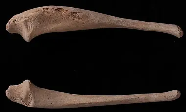 Ученые обнаружили редкую болезнь у ребенка, жившего в XII веке (фото)