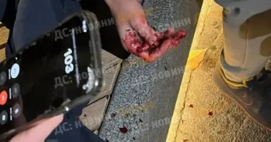 У Дніпрі 15-річному хлопцю відірвало палець внаслідок вибуху невідомого предмета