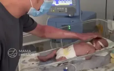Man who suffered 85% burns during attack on Kyiv and lost his wife saw his prematurely born son for first time. VIDEO
