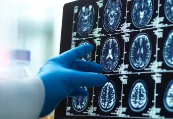 Ранні ознаки деменції: експерт назвав п’ять тривожних сигналів, які не можна ігнорувати