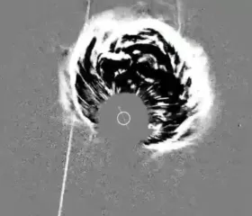 Космический аппарат сделал фотографию мощного взрыва на обратной стороне Солнца (фото)