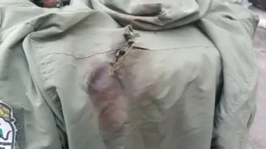 В Україні фіксують хворобу, якої не було з часів Першої світової війни — The Telegraph