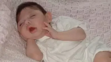 Родившаяся без мозга женщина отпраздновала 20-летие — фото