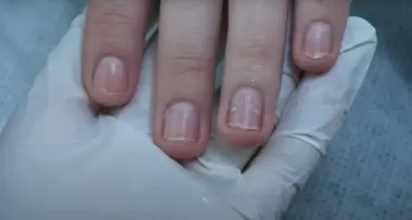 Осенние овощи для здоровья и красоты: что нужно есть, чтобы ногти перестали ломаться