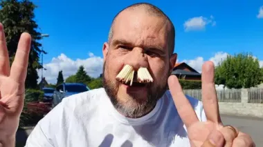 Мужчина запихнул в нос рекордное количество спичек — фото