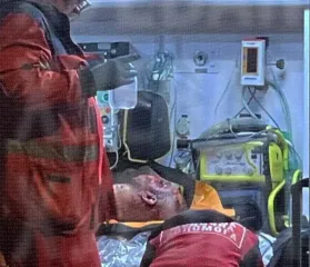 Вибух в Одесі: чоловік підрвав гранати у під’їзді