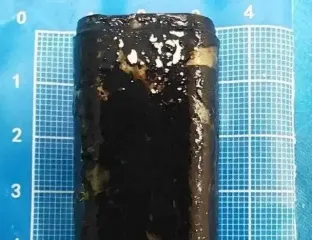 Мужчина прожил 30 лет с зажигалкой в желудке - она до сих пор работала