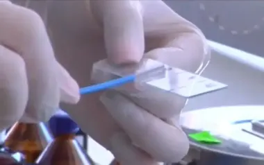 Без дорогих ліків та процедур: лікарі пояснили, як знизити холестерин у крові